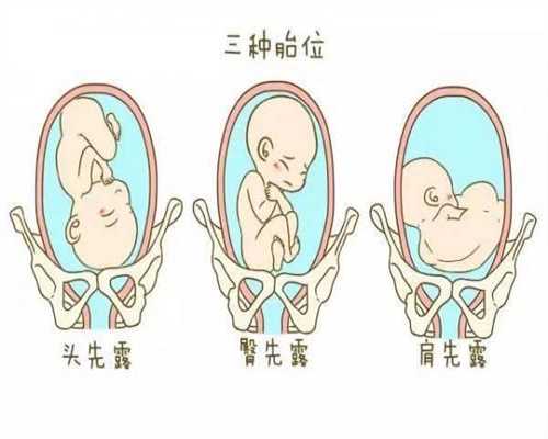 武汉代孕在线咨询_如何开发宝宝智力