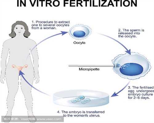 代孕保密咨询_排卵期出血症状有哪些 原因是什么